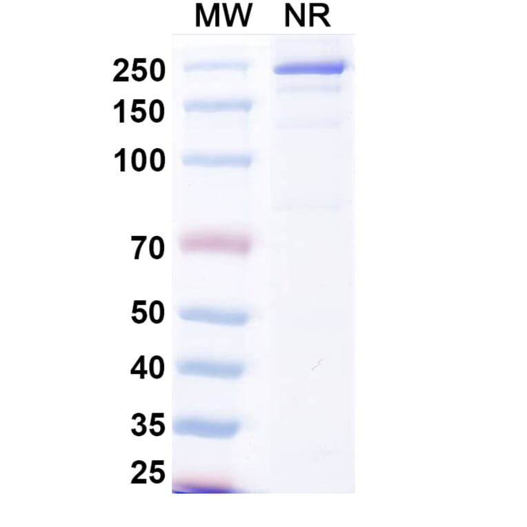 SDS-PAGE - Beludavimab Biosimilar - Anti-SARS-CoV-2 Spike Protein RBD Antibody - BSA and Azide free (A339179) - Antibodies.com