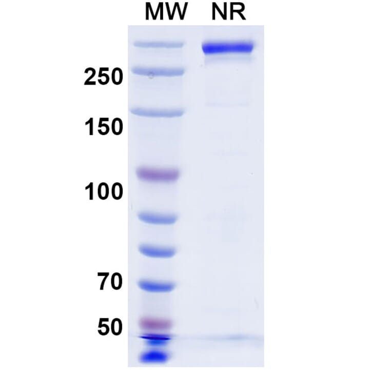 SDS-PAGE - Beludavimab Biosimilar - Anti-SARS-CoV-2 Spike Protein RBD Antibody - BSA and Azide free (A339179) - Antibodies.com
