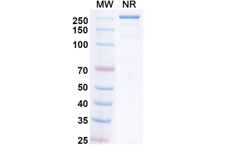 SDS-PAGE - Upanovimab Biosimilar - Anti-SARS-CoV-2 Spike Protein RBD Antibody - BSA and Azide free (A339180) - Antibodies.com