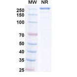 SDS-PAGE - Upanovimab Biosimilar - Anti-SARS-CoV-2 Spike Protein RBD Antibody - BSA and Azide free (A339180) - Antibodies.com