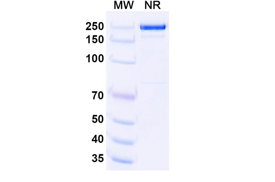 SDS-PAGE - Upanovimab Biosimilar - Anti-SARS-CoV-2 Spike Protein RBD Antibody - BSA and Azide free (A339180) - Antibodies.com