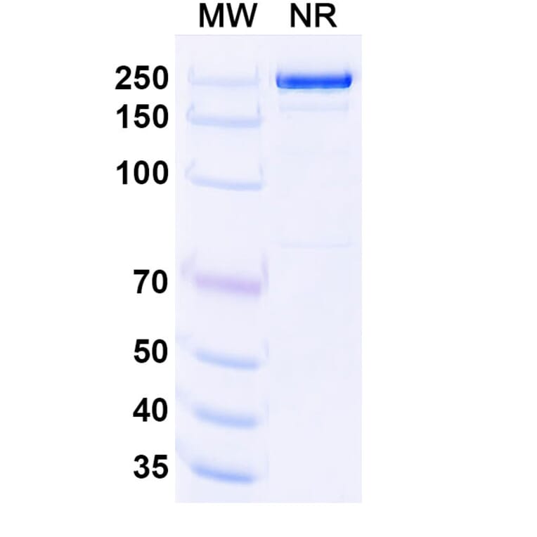SDS-PAGE - Upanovimab Biosimilar - Anti-SARS-CoV-2 Spike Protein RBD Antibody - BSA and Azide free (A339180) - Antibodies.com
