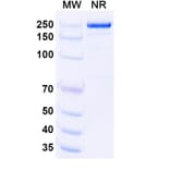 SDS-PAGE - Upanovimab Biosimilar - Anti-SARS-CoV-2 Spike Protein RBD Antibody - BSA and Azide free (A339180) - Antibodies.com