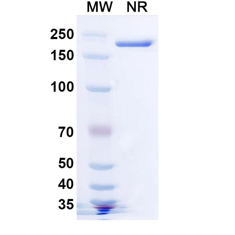 SDS-PAGE - Lomtegovimab Biosimilar - Anti-SARS-CoV-2 Spike Protein RBD Antibody - BSA and Azide free (A339183) - Antibodies.com