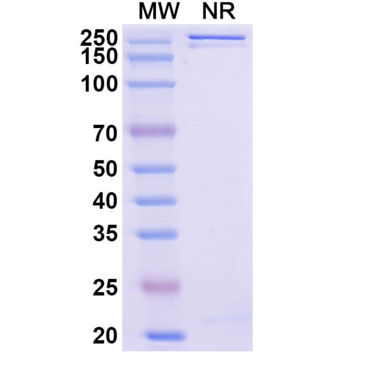 SDS-PAGE - Enuzovimab Biosimilar - Anti-SARS-CoV-2 Spike Protein RBD Antibody - BSA and Azide free (A339184) - Antibodies.com