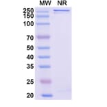 SDS-PAGE - Enuzovimab Biosimilar - Anti-SARS-CoV-2 Spike Protein RBD Antibody - BSA and Azide free (A339184) - Antibodies.com