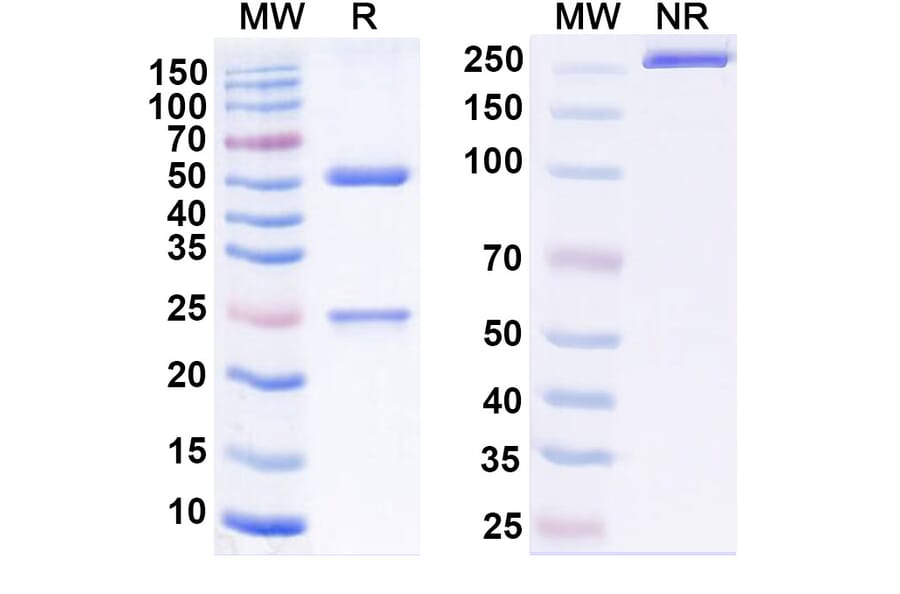 SDS-PAGE - Adintrevimab Biosimilar - Anti-SARS-CoV-2 Spike Protein RBD Antibody - BSA and Azide free (A339185) - Antibodies.com