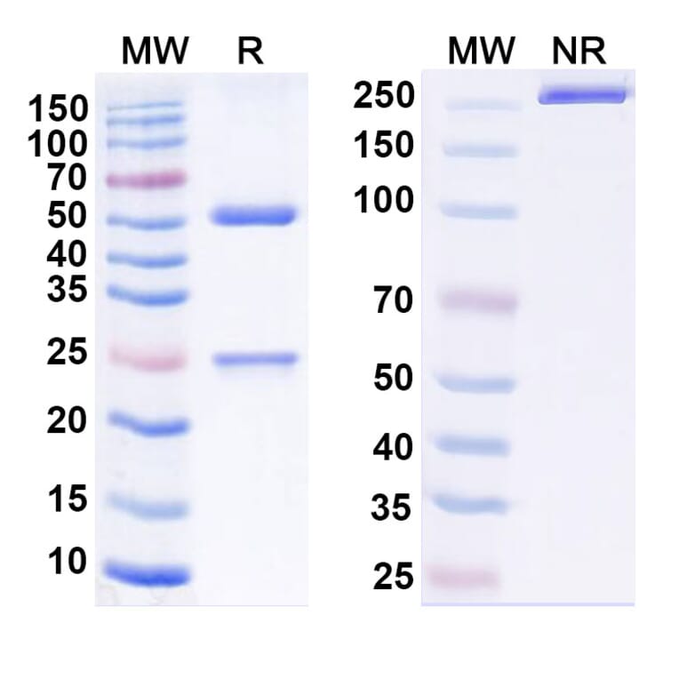 SDS-PAGE - Adintrevimab Biosimilar - Anti-SARS-CoV-2 Spike Protein RBD Antibody - BSA and Azide free (A339185) - Antibodies.com