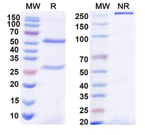 SDS-PAGE - Anti-Diphtheria toxin Antibody [DTD4] Biosimilar - BSA and Azide free (A339187) - Antibodies.com