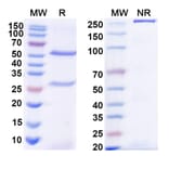 SDS-PAGE - Anti-Diphtheria toxin Antibody [DTD4] Biosimilar - BSA and Azide free (A339187) - Antibodies.com