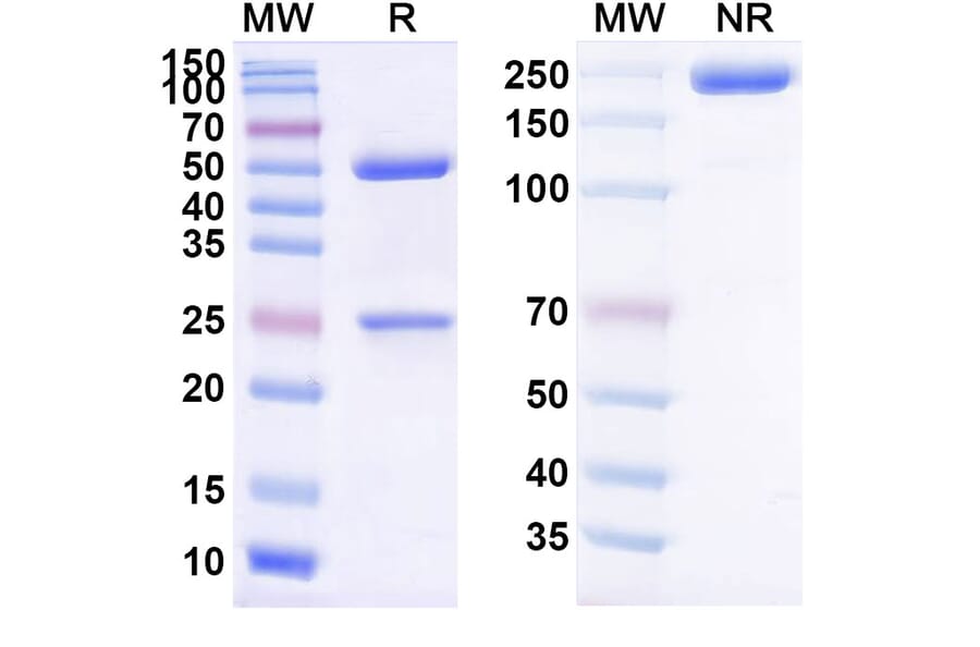 SDS-PAGE - DXP-604 Biosimilar - Anti-SARS-CoV-2 Spike Protein RBD Antibody - BSA and Azide free (A339191) - Antibodies.com