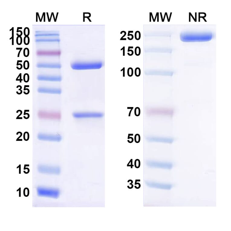 SDS-PAGE - DXP-604 Biosimilar - Anti-SARS-CoV-2 Spike Protein RBD Antibody - BSA and Azide free (A339191) - Antibodies.com