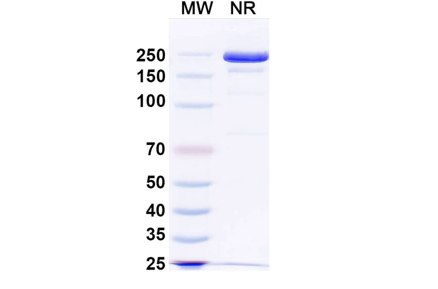 SDS-PAGE - JMB2002 Biosimilar - Anti-SARS-CoV-2 Spike Protein RBD Antibody - BSA and Azide free (A339196) - Antibodies.com