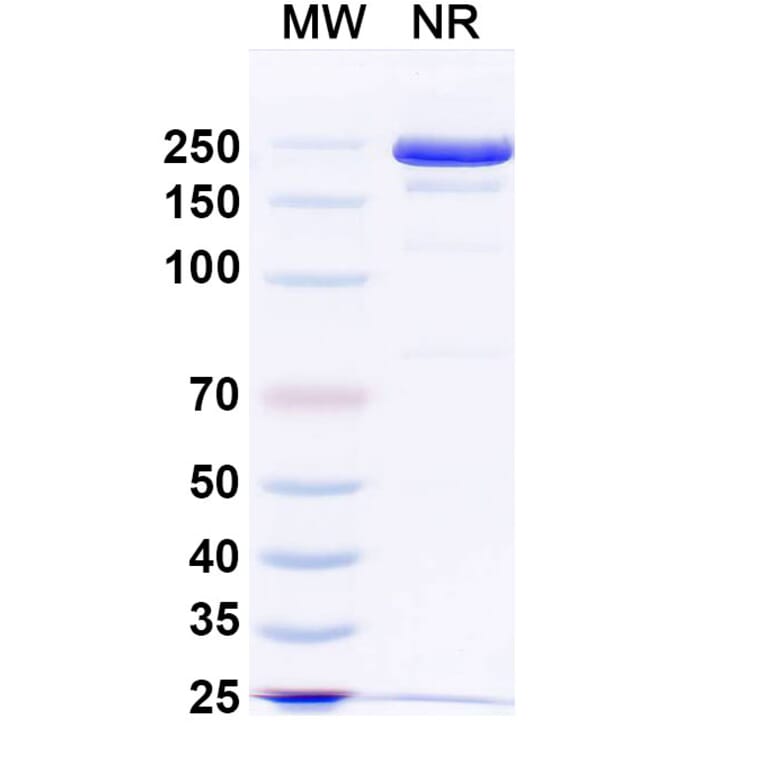 SDS-PAGE - JMB2002 Biosimilar - Anti-SARS-CoV-2 Spike Protein RBD Antibody - BSA and Azide free (A339196) - Antibodies.com