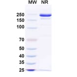 SDS-PAGE - JMB2002 Biosimilar - Anti-SARS-CoV-2 Spike Protein RBD Antibody - BSA and Azide free (A339196) - Antibodies.com