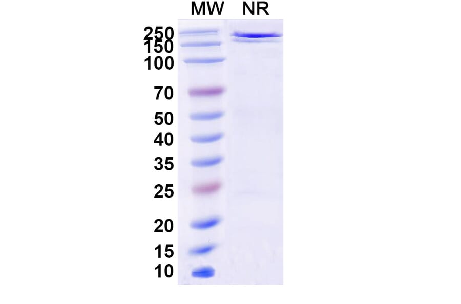 SDS-PAGE - JMB2002 Biosimilar - Anti-SARS-CoV-2 Spike Protein RBD Antibody - BSA and Azide free (A339196) - Antibodies.com