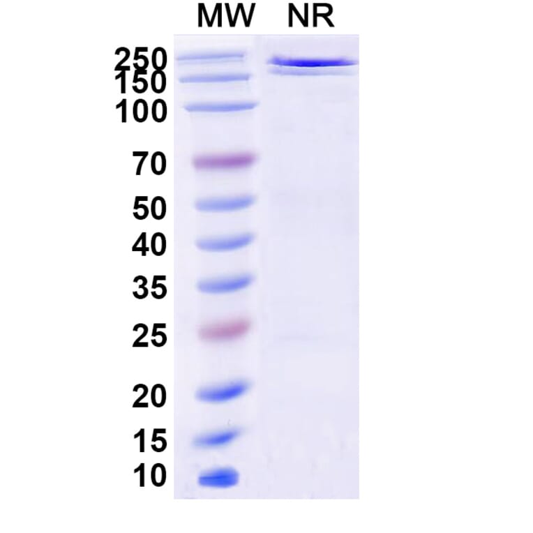 SDS-PAGE - JMB2002 Biosimilar - Anti-SARS-CoV-2 Spike Protein RBD Antibody - BSA and Azide free (A339196) - Antibodies.com