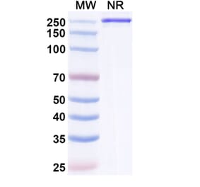 SDS-PAGE - Semzuvolimab Biosimilar - Anti-CD4 Antibody - BSA and Azide free (A339199) - Antibodies.com