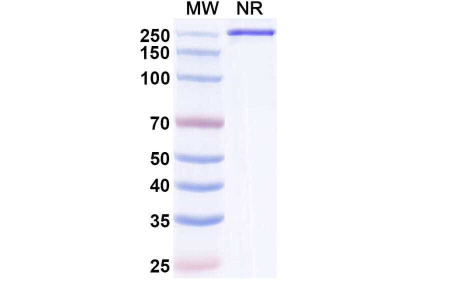 SDS-PAGE - Semzuvolimab Biosimilar - Anti-CD4 Antibody - BSA and Azide free (A339199) - Antibodies.com