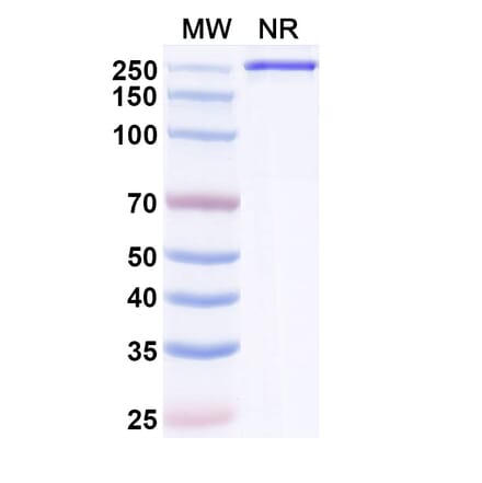 SDS-PAGE - Semzuvolimab Biosimilar - Anti-CD4 Antibody - BSA and Azide free (A339199) - Antibodies.com