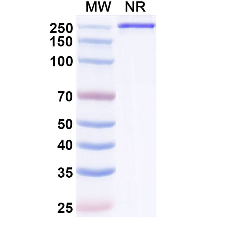 SDS-PAGE - Semzuvolimab Biosimilar - Anti-CD4 Antibody - BSA and Azide free (A339199) - Antibodies.com