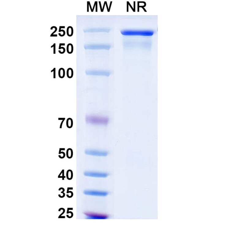 SDS-PAGE - Semzuvolimab Biosimilar - Anti-CD4 Antibody - BSA and Azide free (A339199) - Antibodies.com