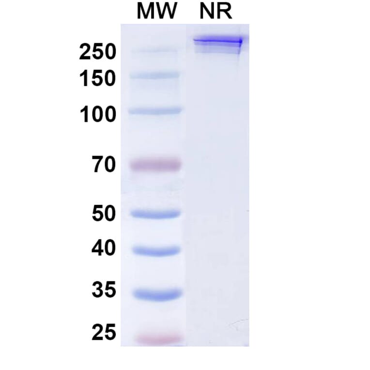 SDS-PAGE - Inezetamab Biosimilar - Anti-CD40 + Mesothelin Antibody - BSA and Azide free (A339202) - Antibodies.com