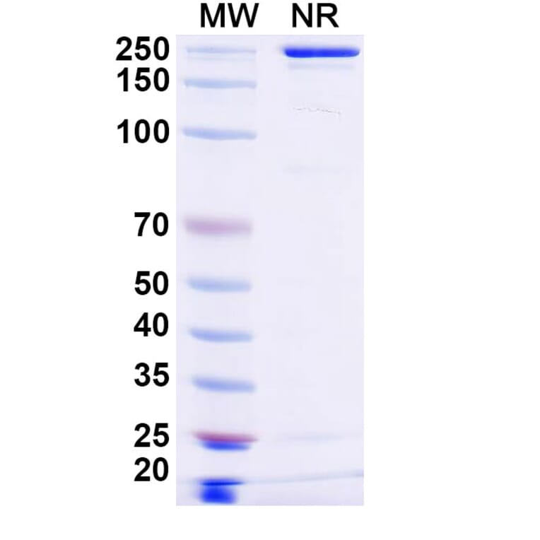 SDS-PAGE - Ispectamab Biosimilar - Anti-BCMA Antibody - BSA and Azide free (A339204) - Antibodies.com