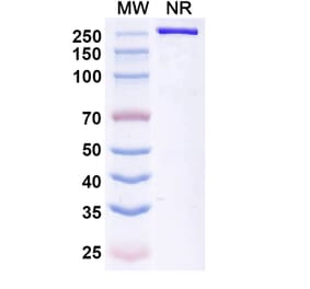 SDS-PAGE - Betifisolimab Biosimilar - Anti-PD-L1 Antibody - BSA and Azide free (A339205) - Antibodies.com
