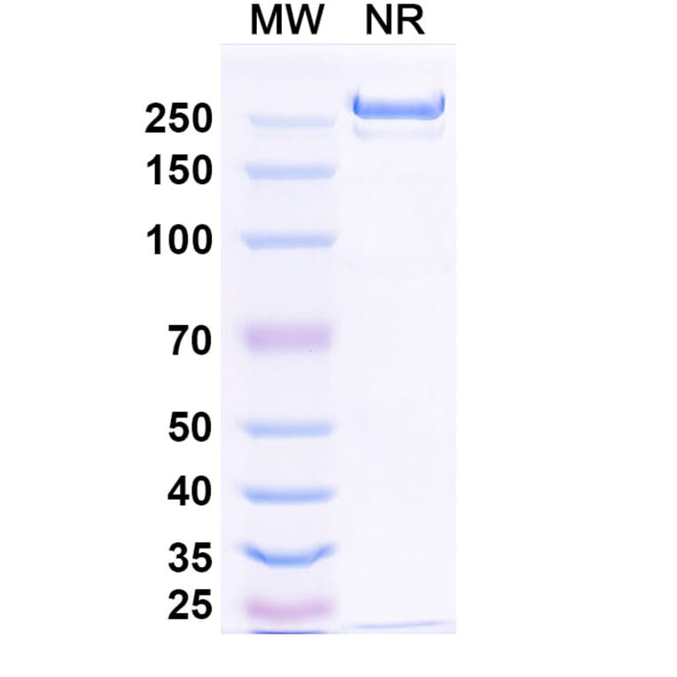 SDS-PAGE - Betifisolimab Biosimilar - Anti-PD-L1 Antibody - BSA and Azide free (A339205) - Antibodies.com