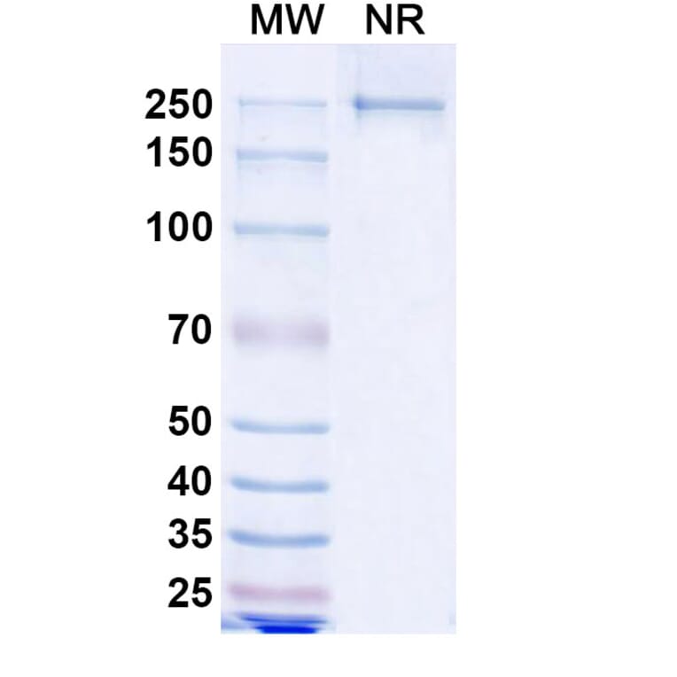 SDS-PAGE - Lesabelimab Biosimilar - Anti-PD-L1 Antibody - BSA and Azide free (A339206) - Antibodies.com