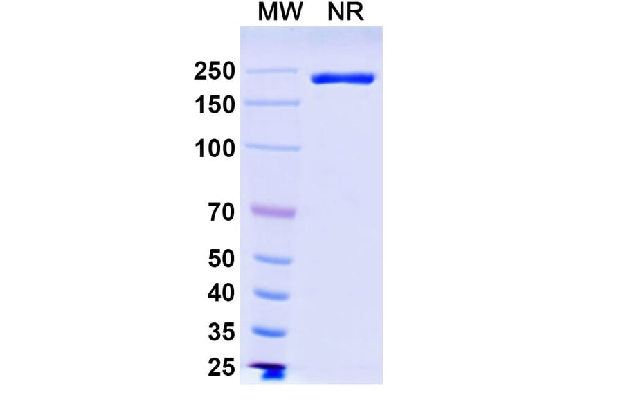 SDS-PAGE - Ifinatamab Biosimilar - Anti-B7-H3 Antibody - BSA and Azide free (A339208) - Antibodies.com
