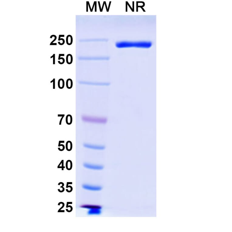 SDS-PAGE - Ifinatamab Biosimilar - Anti-B7-H3 Antibody - BSA and Azide free (A339208) - Antibodies.com