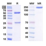 SDS-PAGE - Vobramitamab Biosimilar - Anti-B7-H3 Antibody - BSA and Azide free (A339209) - Antibodies.com
