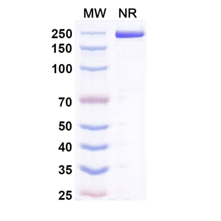 SDS-PAGE - Acrixolimab Biosimilar - Anti-PD 1 Antibody - BSA and Azide free (A339210) - Antibodies.com
