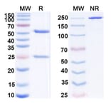 SDS-PAGE - Peresolimab Biosimilar - Anti-PD 1 Antibody - BSA and Azide free (A339211) - Antibodies.com