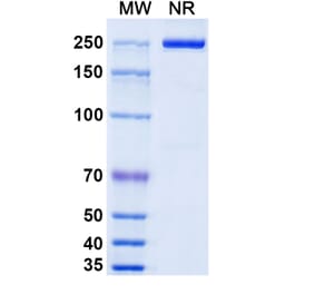 SDS-PAGE - Camoteskimab Biosimilar - Anti-IL-18 Antibody - BSA and Azide free (A339217) - Antibodies.com