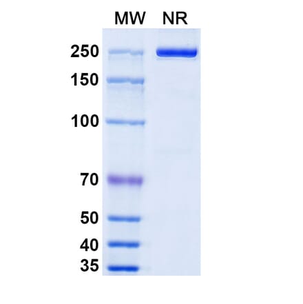 SDS-PAGE - Camoteskimab Biosimilar - Anti-IL-18 Antibody - BSA and Azide free (A339217) - Antibodies.com