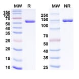 SDS-PAGE - Crefmirlimab Biosimilar - Anti-CD8 alpha Antibody - BSA and Azide free (A339218) - Antibodies.com