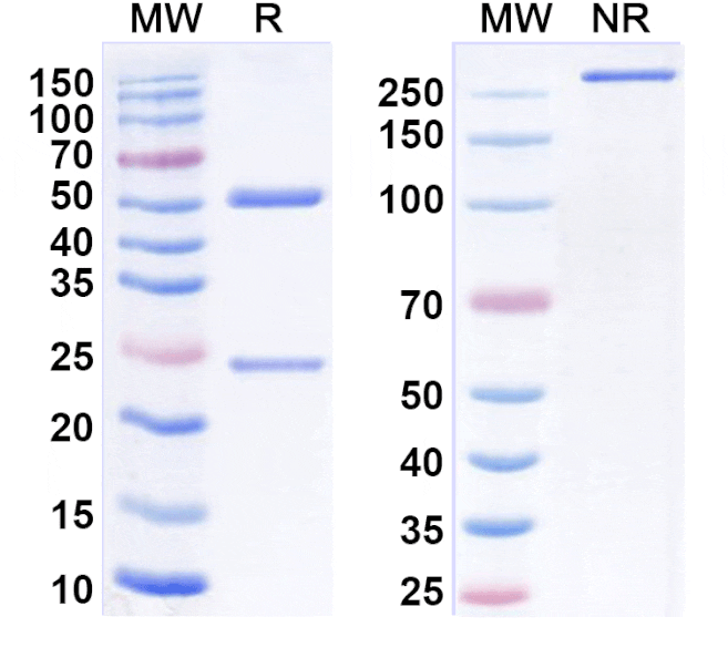 SDS-PAGE - Golocdacimab Biosimilar - Anti-OLR1 Antibody - BSA and Azide free (A339223) - Antibodies.com