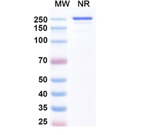 SDS-PAGE - Luveltamab Biosimilar - Anti-FOLR1 Antibody - BSA and Azide free (A339229) - Antibodies.com