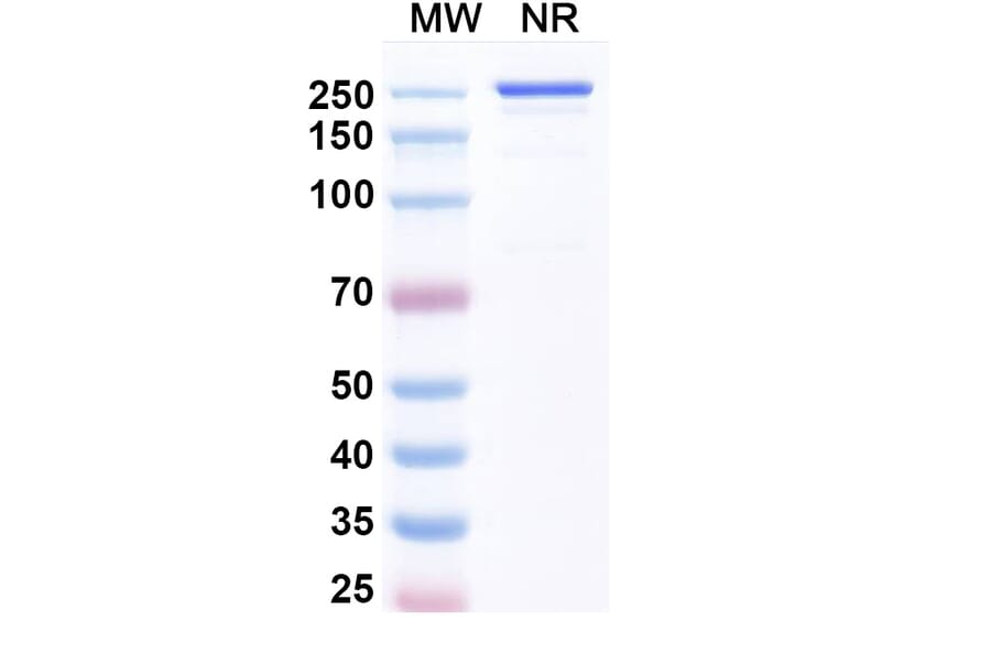 SDS-PAGE - Luveltamab Biosimilar - Anti-FOLR1 Antibody - BSA and Azide free (A339229) - Antibodies.com