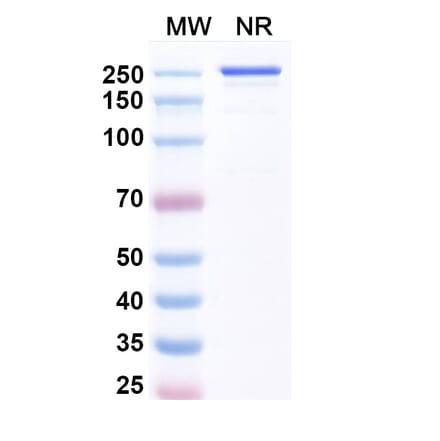 SDS-PAGE - Luveltamab Biosimilar - Anti-FOLR1 Antibody - BSA and Azide free (A339229) - Antibodies.com