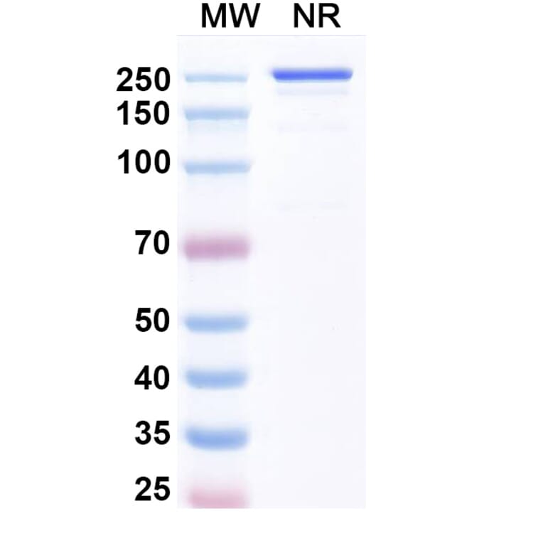 SDS-PAGE - Luveltamab Biosimilar - Anti-FOLR1 Antibody - BSA and Azide free (A339229) - Antibodies.com