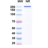 SDS-PAGE - Luveltamab Biosimilar - Anti-FOLR1 Antibody - BSA and Azide free (A339229) - Antibodies.com