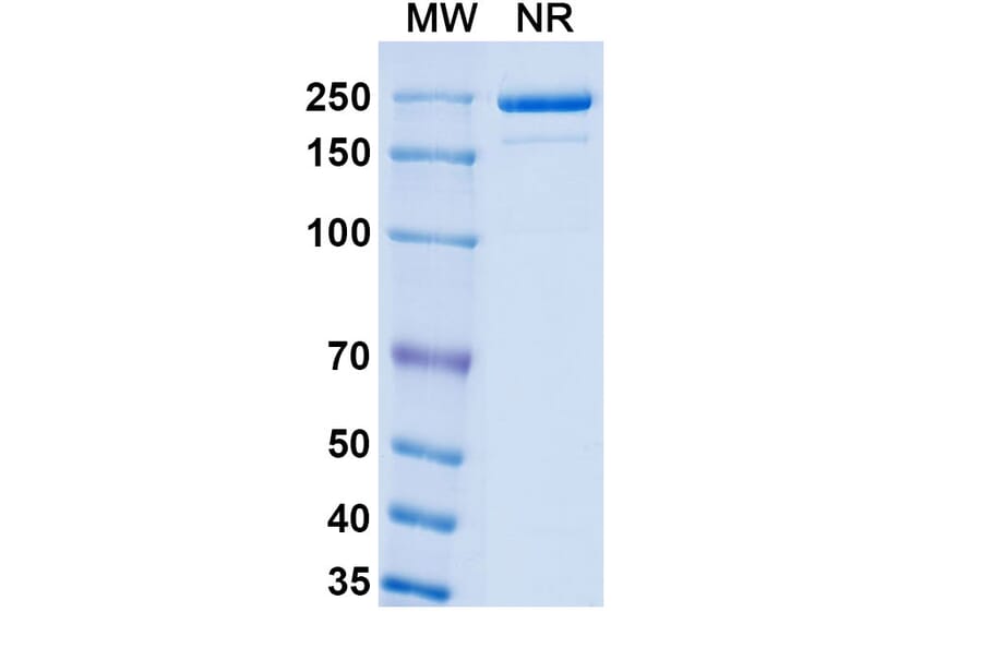 SDS-PAGE - Luveltamab Biosimilar - Anti-FOLR1 Antibody - BSA and Azide free (A339229) - Antibodies.com