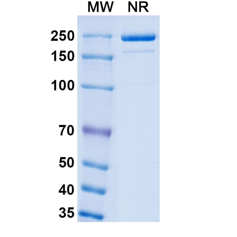 SDS-PAGE - Luveltamab Biosimilar - Anti-FOLR1 Antibody - BSA and Azide free (A339229) - Antibodies.com