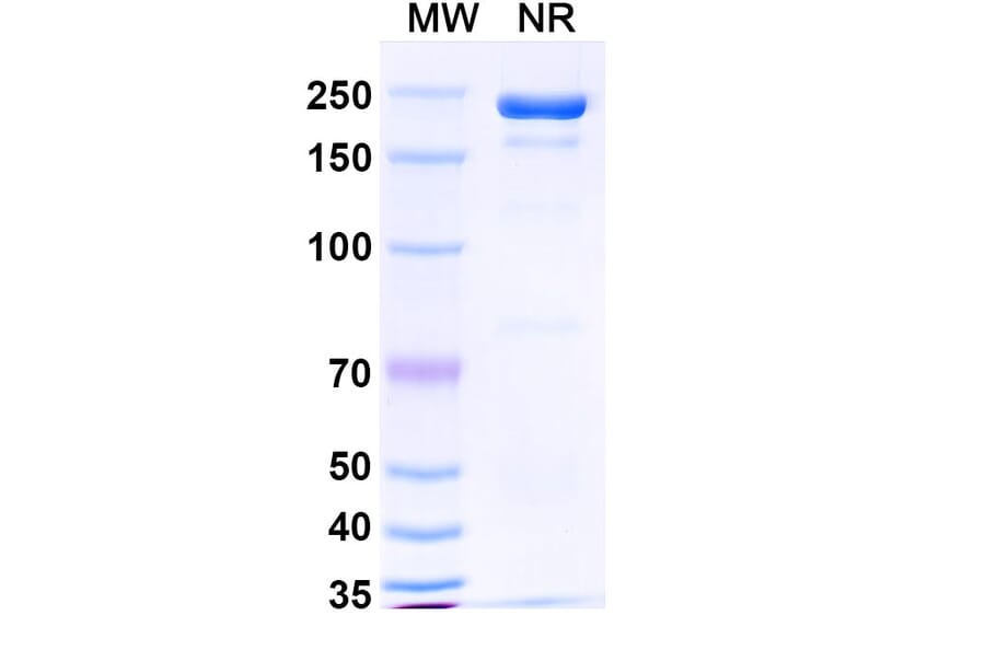 SDS-PAGE - Masavibart Biosimilar - Anti-SARS-CoV-2 Spike Protein RBD Antibody - BSA and Azide free (A339231) - Antibodies.com