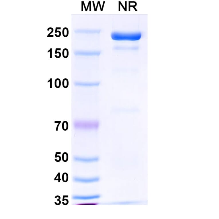 SDS-PAGE - Masavibart Biosimilar - Anti-SARS-CoV-2 Spike Protein RBD Antibody - BSA and Azide free (A339231) - Antibodies.com