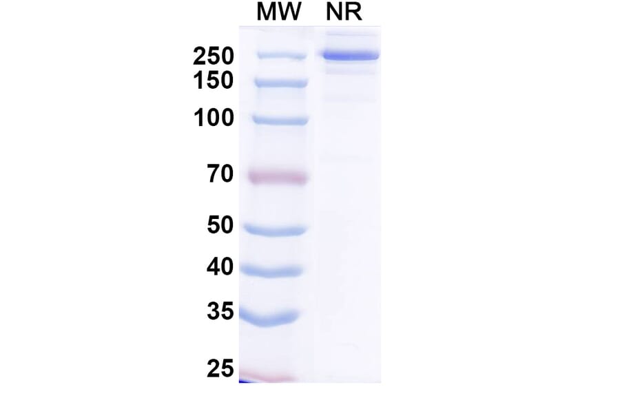 SDS-PAGE - Ogalvibart Biosimilar - Anti-SARS-CoV-2 Spike Protein RBD Antibody - BSA and Azide free (A339233) - Antibodies.com